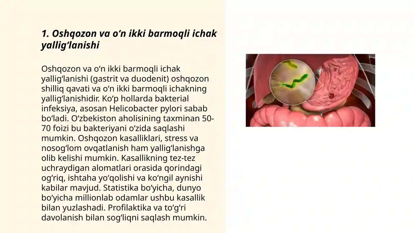 Oshqozon va Oʻn Ikki Barmoqli Ichak Kasalliklar 3