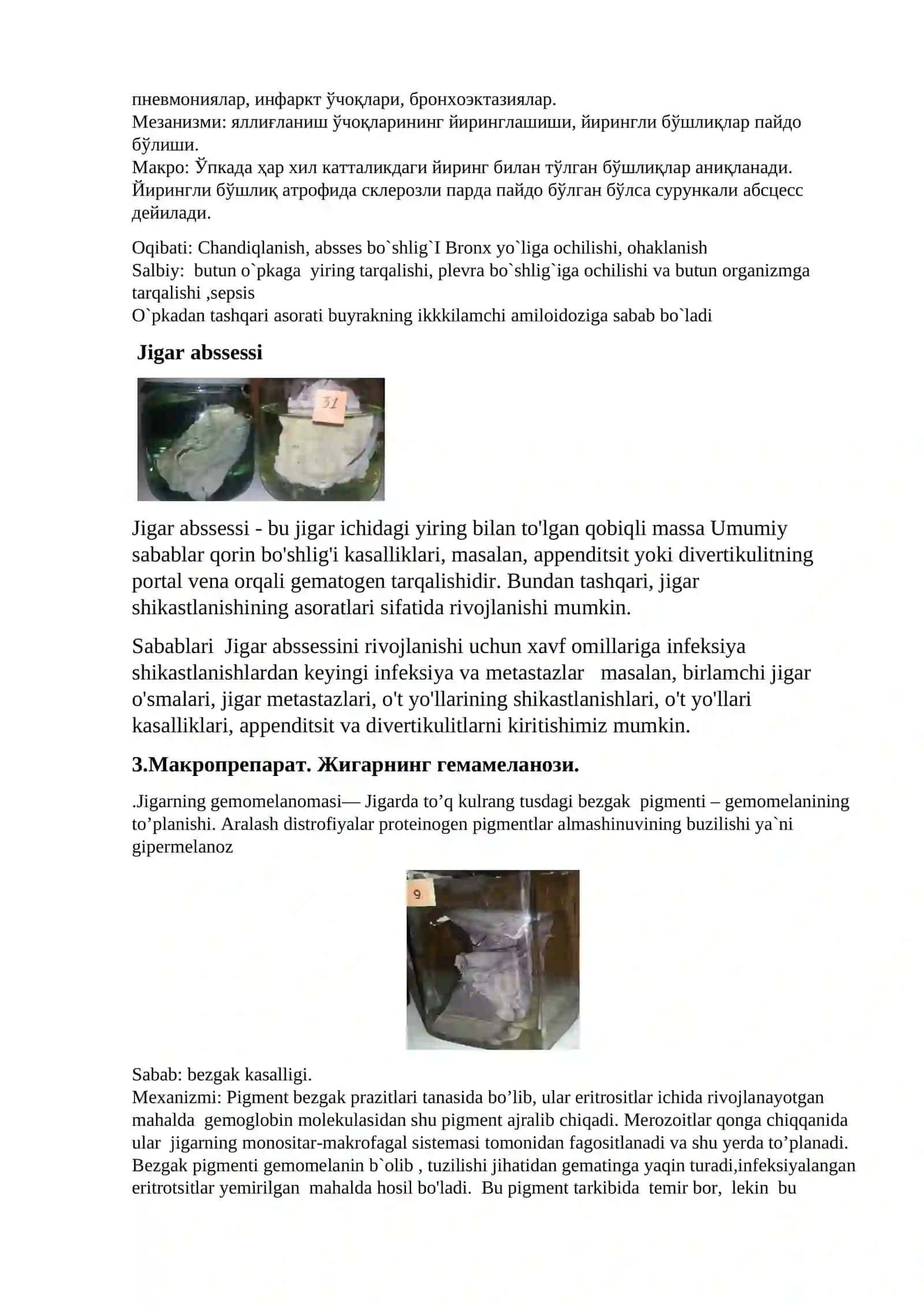 Аортадаги девор олди тромби 3