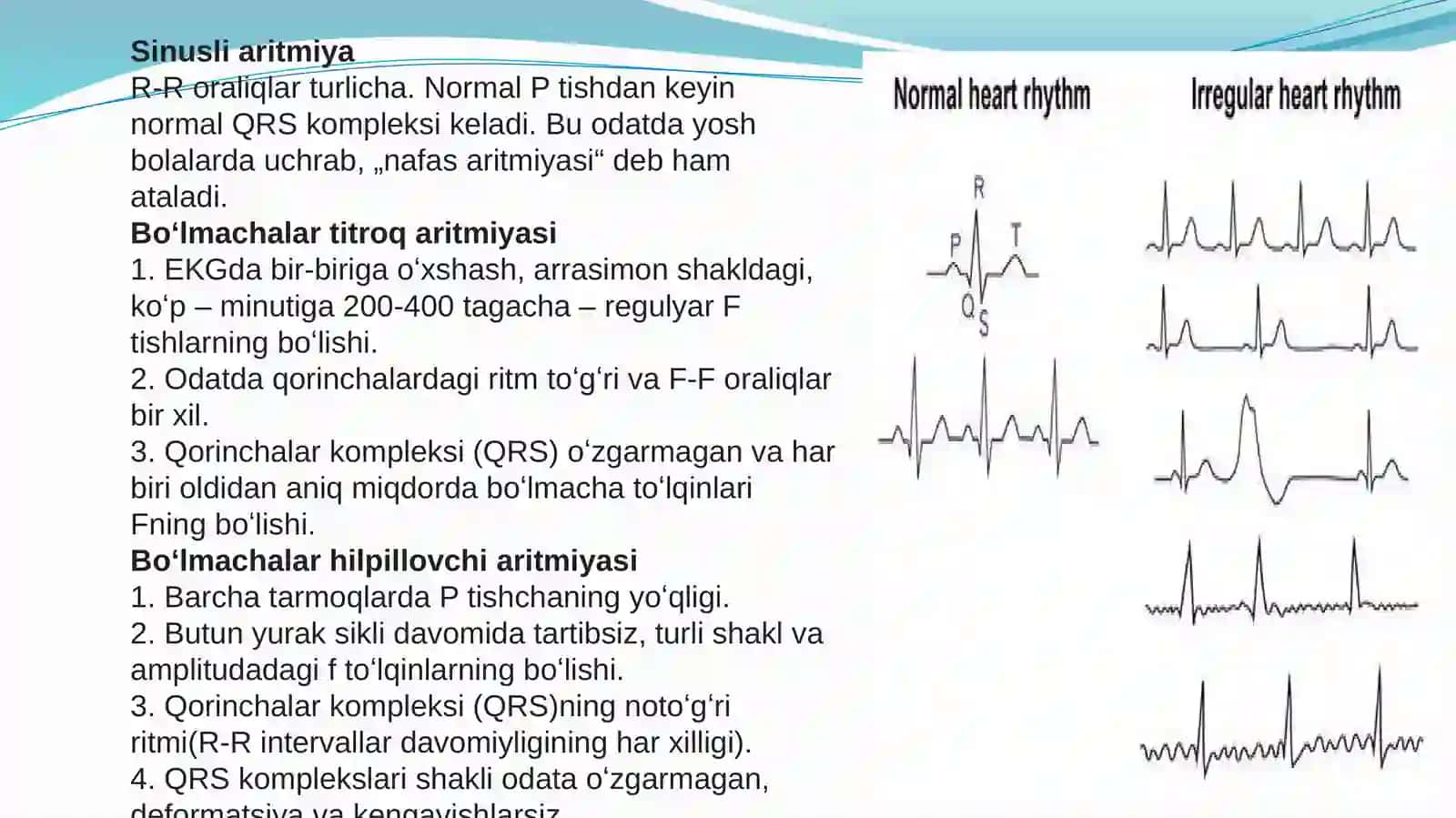 Aritmiyalarda EKG interpretatsiyasi 3