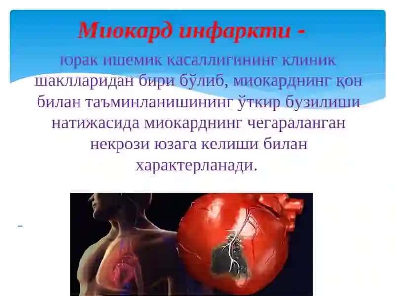 Миокард инфарктитушунчаси 3