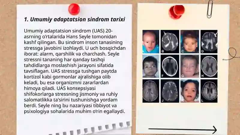 Umumiy adaptatsion sindrom 3