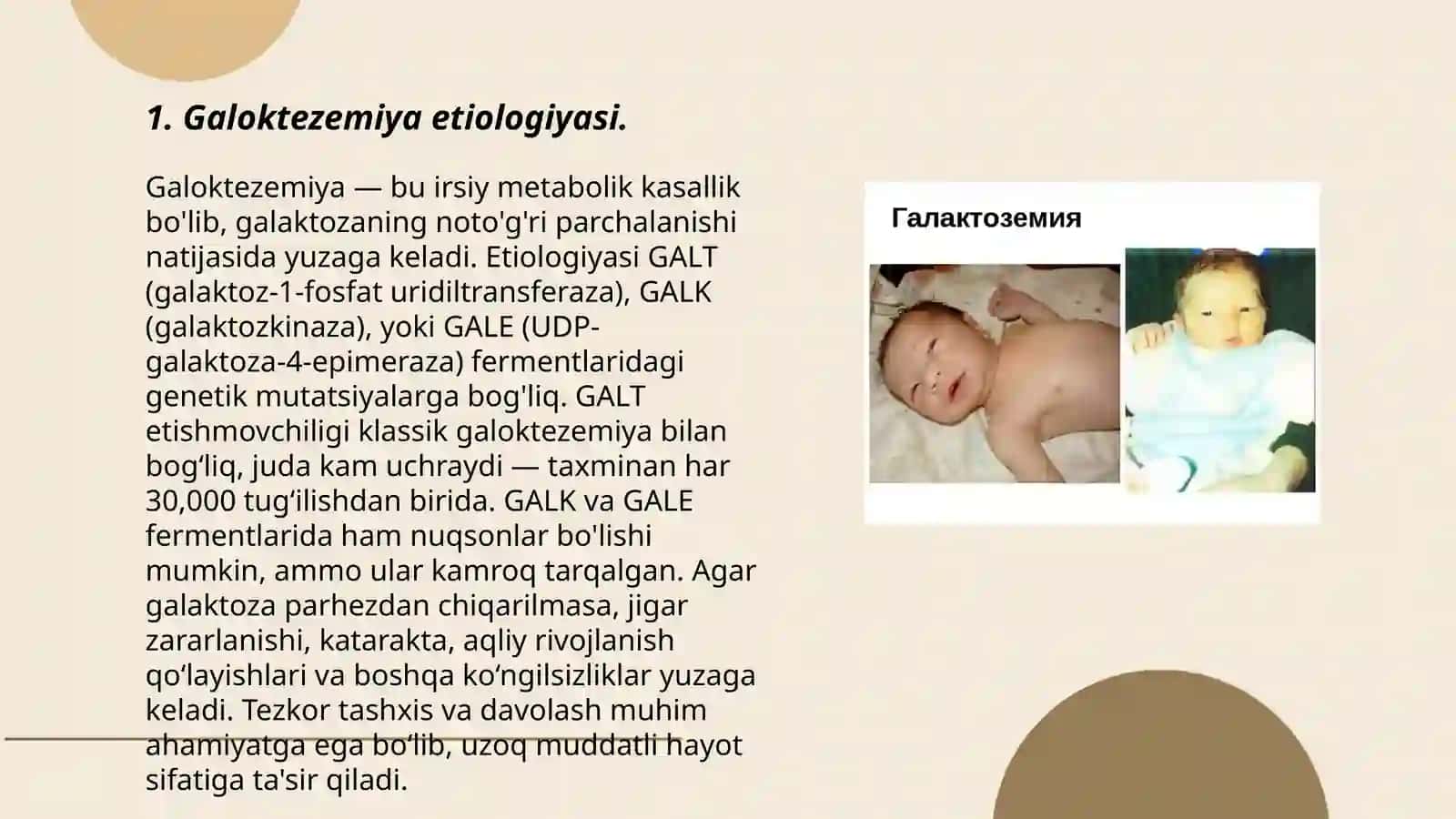Galoktezemiya-etiologiyasi, patogenezi, klinik belgilar, diagnostikasi, davolash va profilaktikasi 3