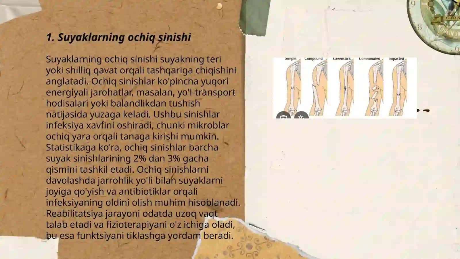Suyaklarning ochiq va yopiq sinishlari 3