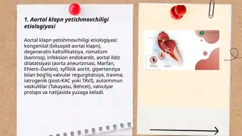 Aortal klapn yetishmovchiligi va stenozi 3