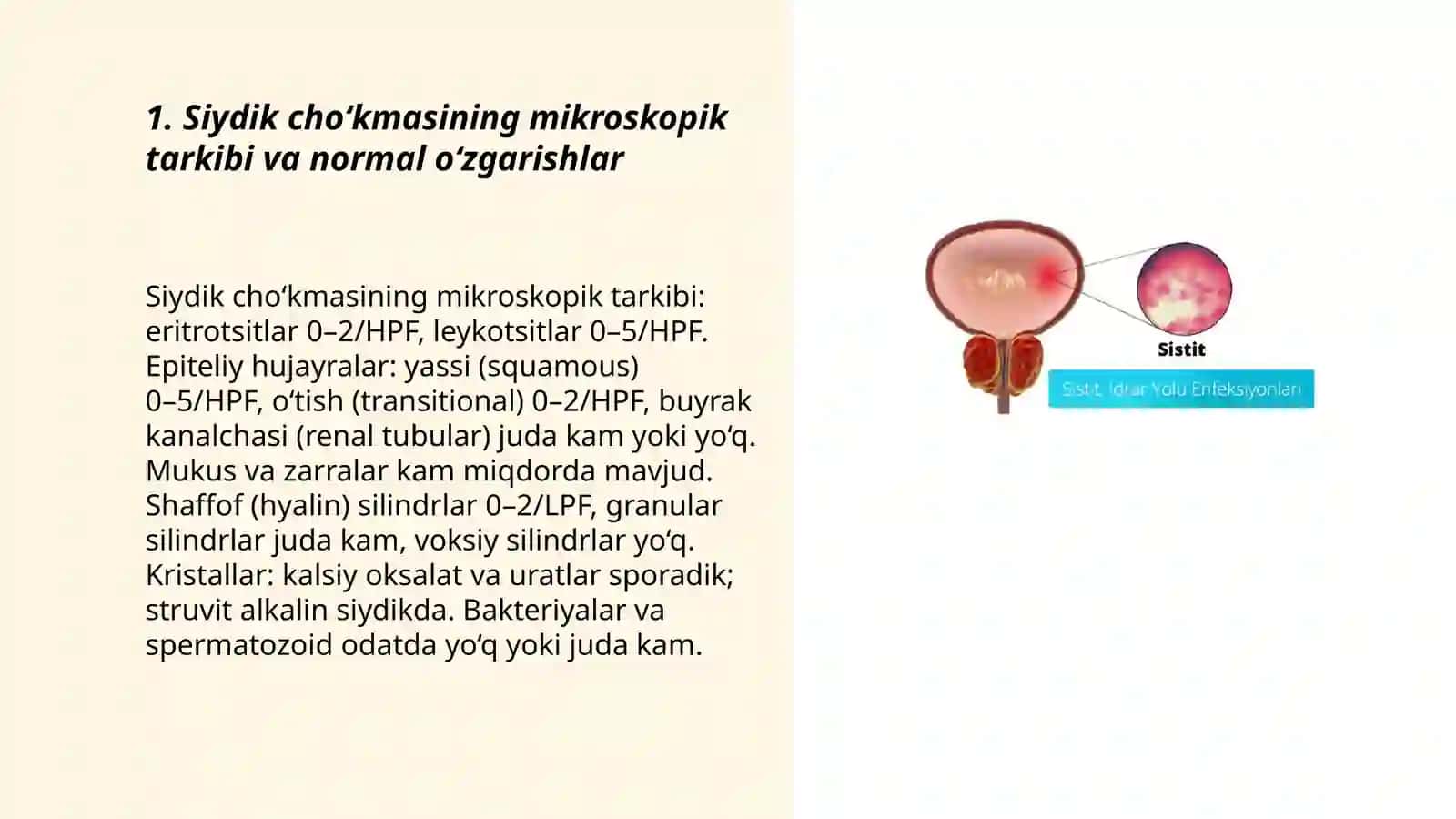 Siydik cho‘kmasidagi o‘zgarishlar 3