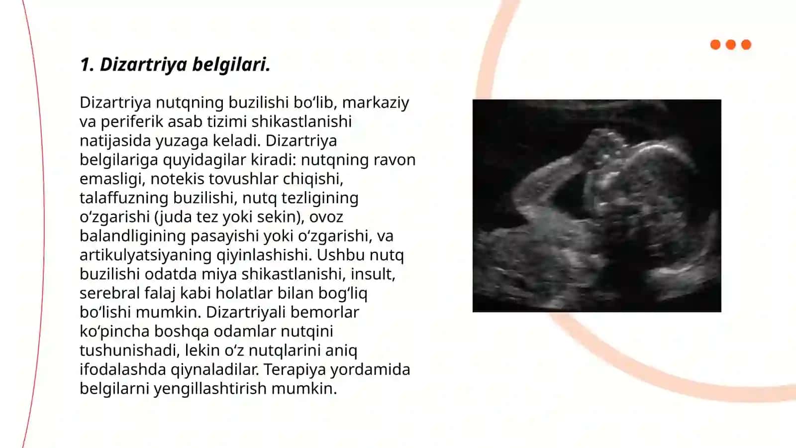 Dizartriya belgilari 3