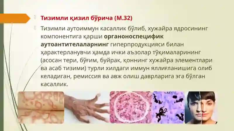 Тизимли Қизил Бўрича 3