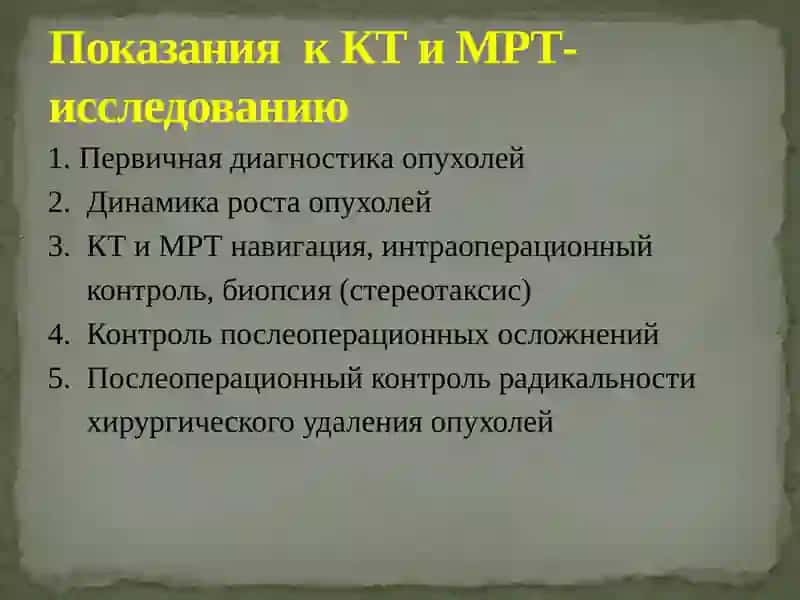 ОПУХОЛИ ГОЛОВНОГО МОЗГА 3