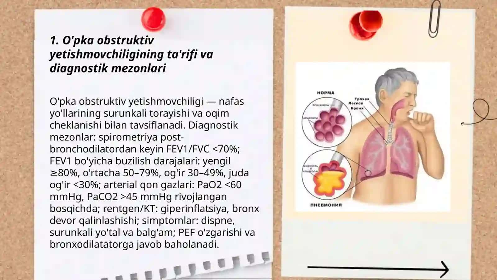 O'pka obstruktiv yetishmovchiligi diagnostikasi 3