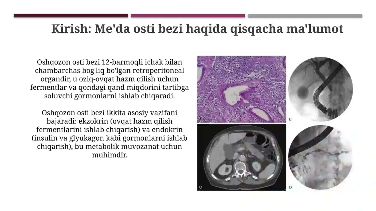 Oshqozon osti bezi etiologiyasi, patogenezi, va tasnifi 3