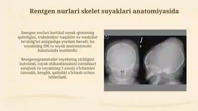 Skelet suyaklarining rentgenanatomiyasi 3