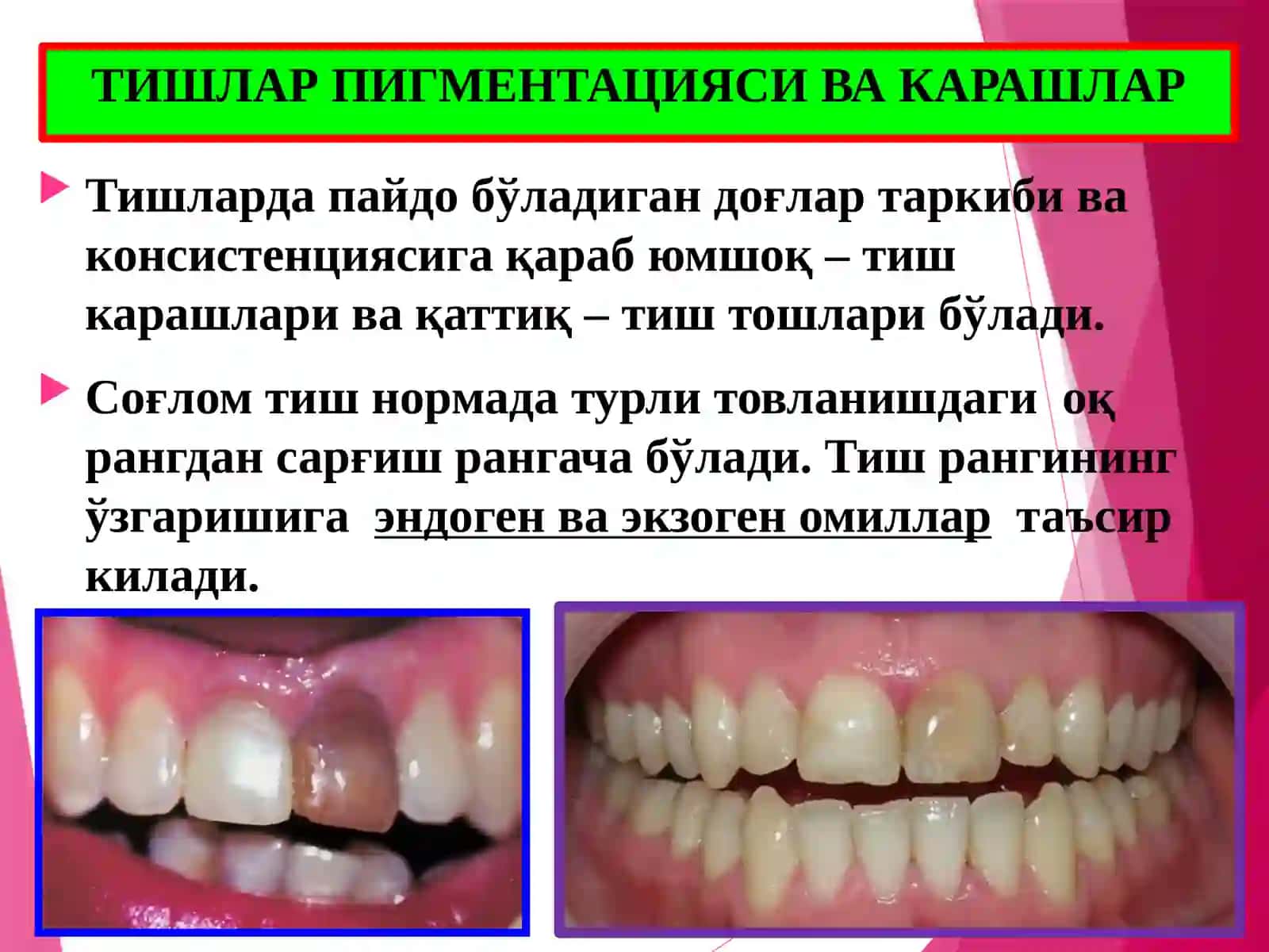 Тиш чиққандан сўнг ривожланадиган нокариоз касалликлар 3