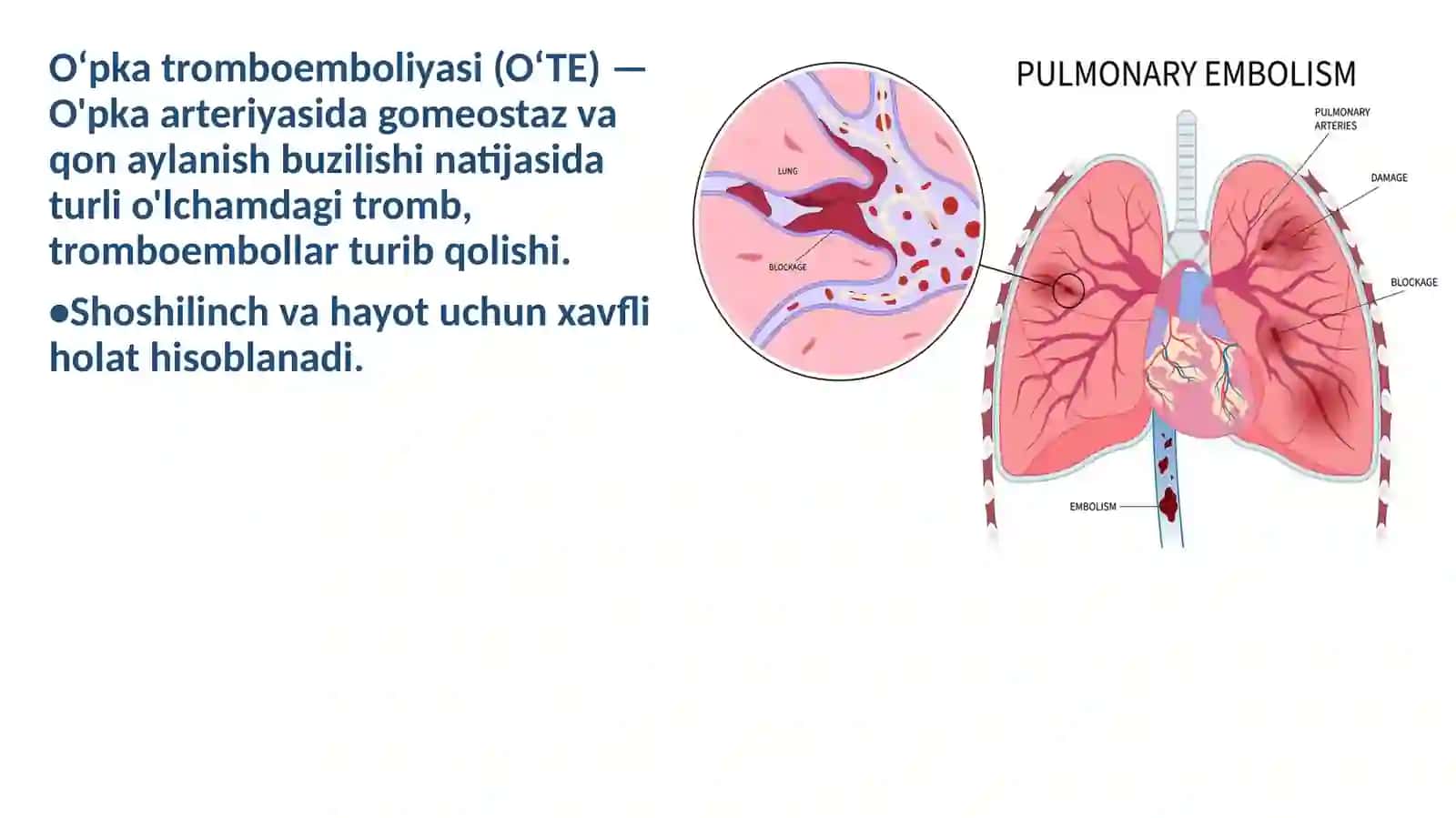 O'pka Tromboemboliyasi 3