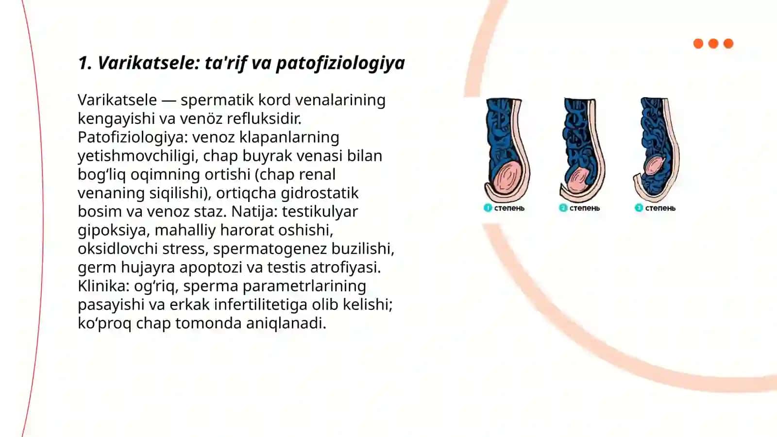 Varikatsele va peyroni kasalligi 3