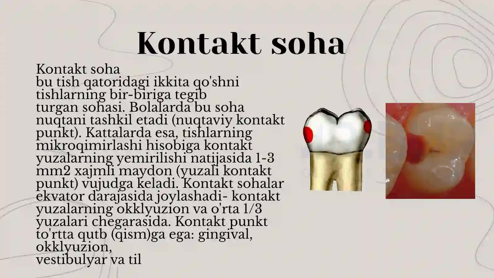BLEK BO'YICHA II SINF KARIES KOVAGINI CHARXLASH USULLARI 3