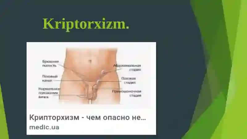 Kriptorxizm 3