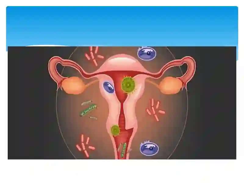 Ureaplazma, Mikoplazma, Kandidoz va Sifilis 3