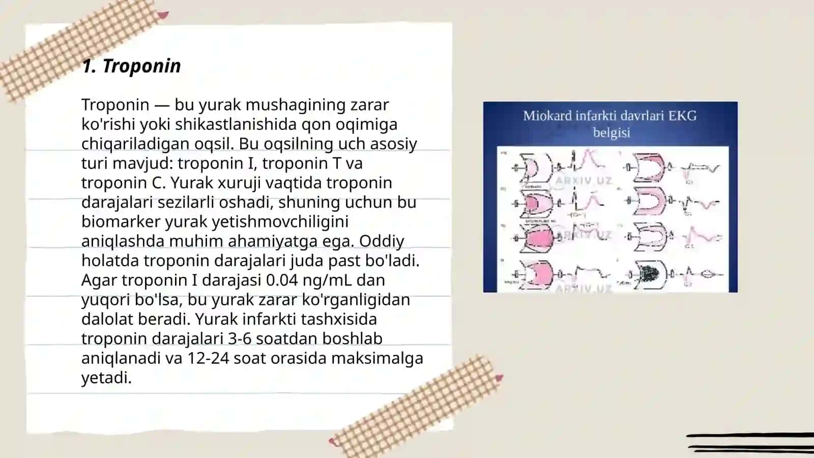 Miokard infarktida labarator ko'rsatkichlar 3