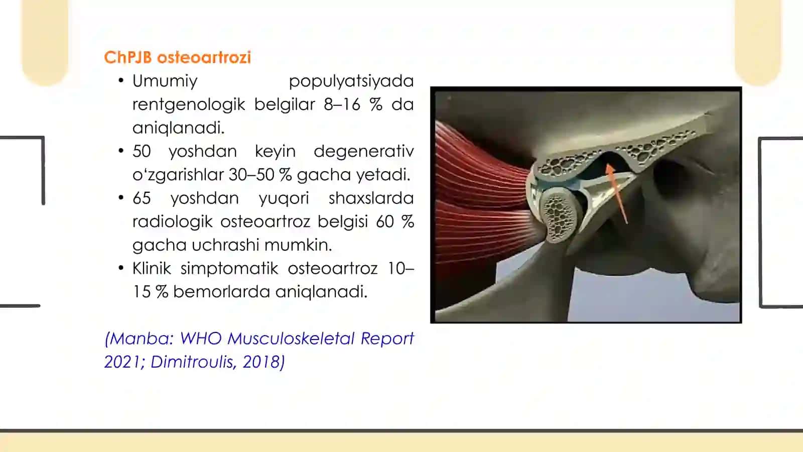 ChPJB DISFUNKSIYA SINDROMI VA OSTEOARTROZ 3