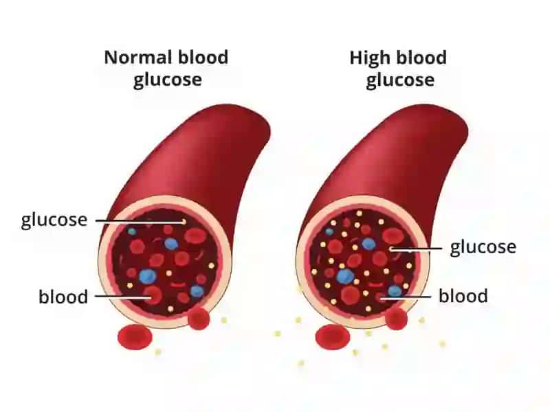 Healthy eating plan for diabetic patients 3