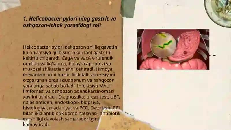 Gastrit oshqozon ichak yarasi va kolit kelib chiqishida mikroorganizmlarning ahamiyati, patogenezi, labaratoriya tashxisi 3