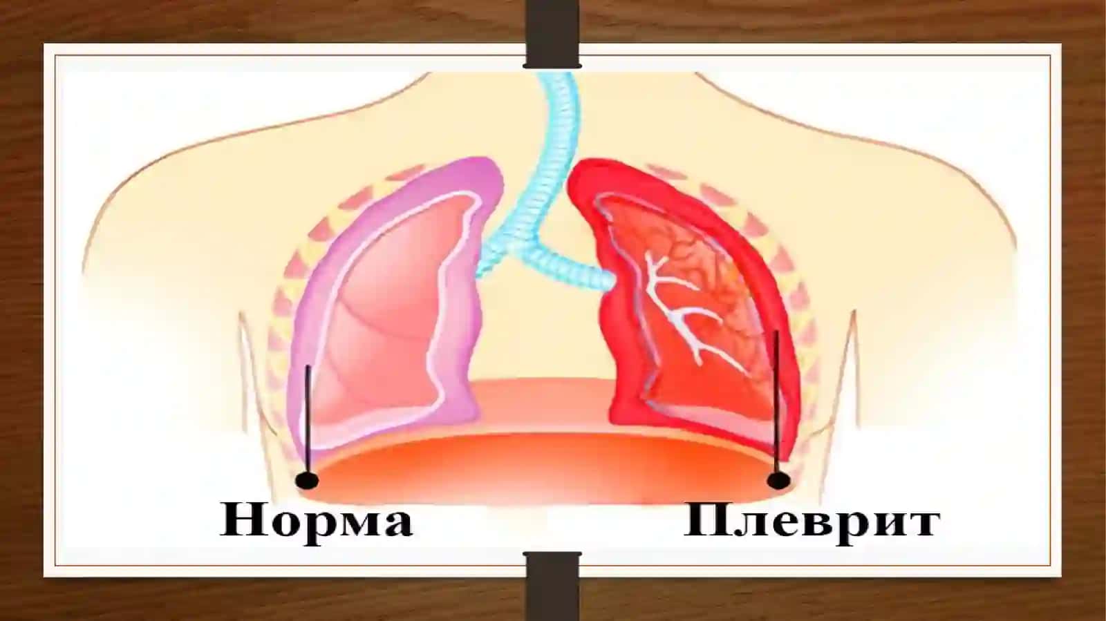 Toshkent Davlat Stomatologiya Instituti Stomatologiyafakulteti 205-"A" guruhta talabasi Dilruxsor Hamidova ning Terapiya fanidantayyorlagan taqdimoti 3