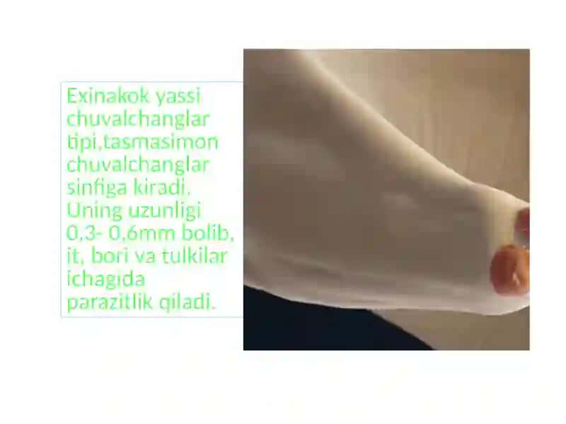 Parazit chuvalchanglarning xilma- xilligi 3