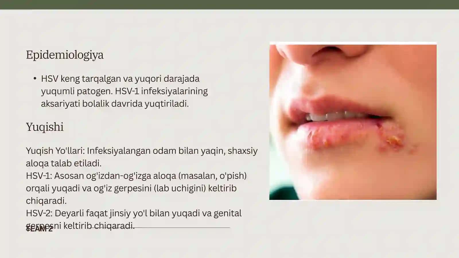 Oʼtkir gerpes va sitomegalovirus 3