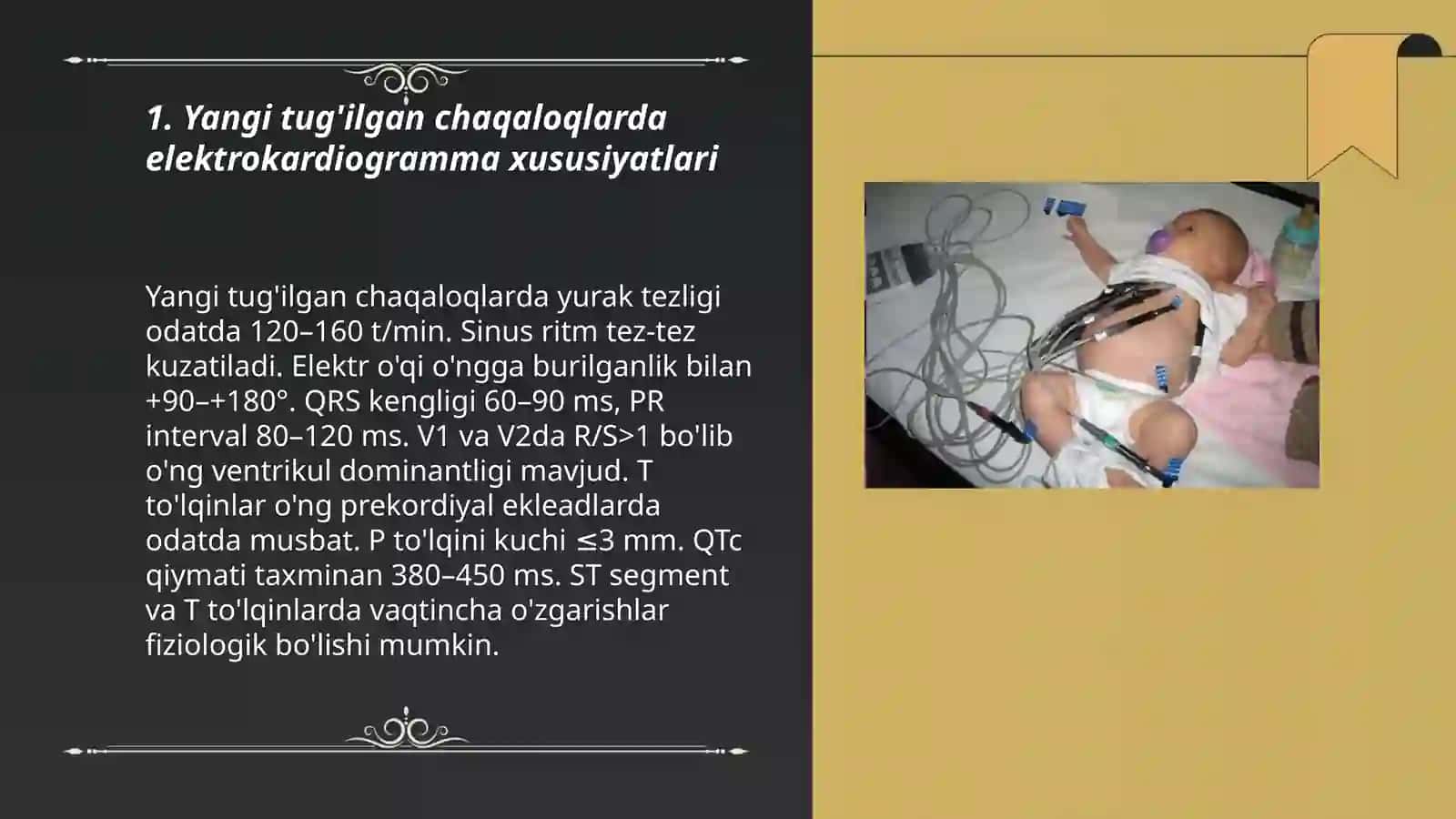 Bolalarda elektrokardiogrammaning yosh xususiyatlari 3
