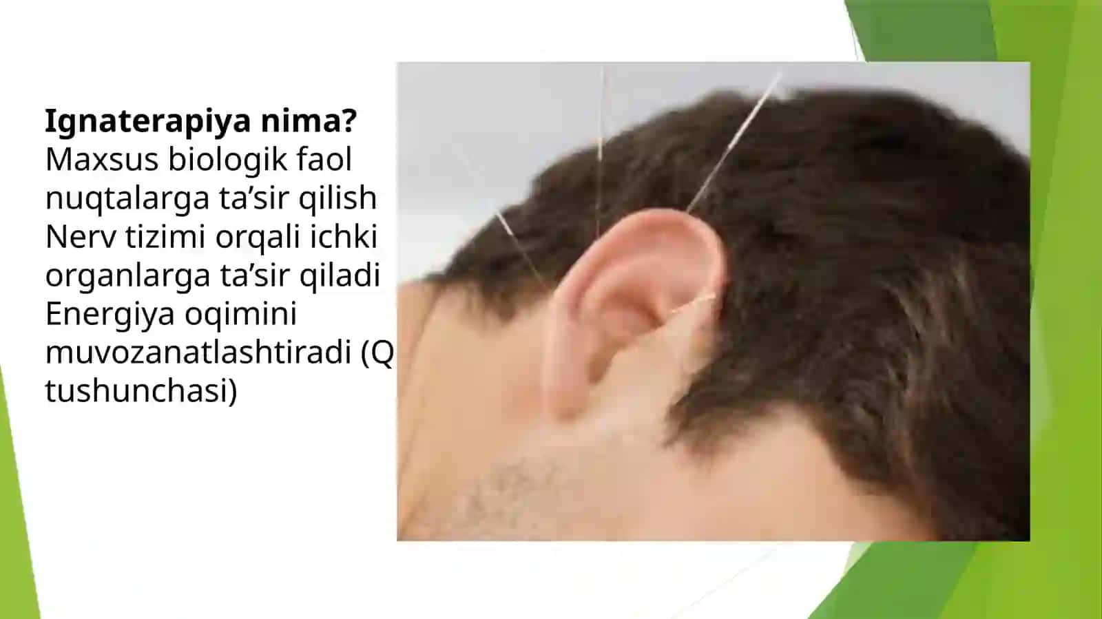 Pediatriyada ignaterapiyaning ahamiyati | Tayyor PPT prezentatsiya 3
