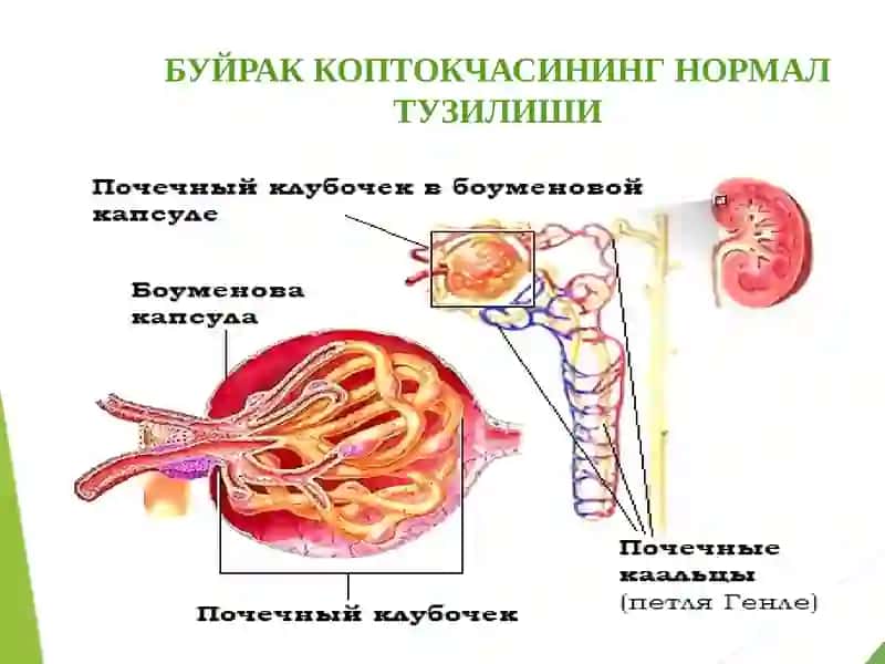 Туғманефритлар.Гломерулонефрит 3