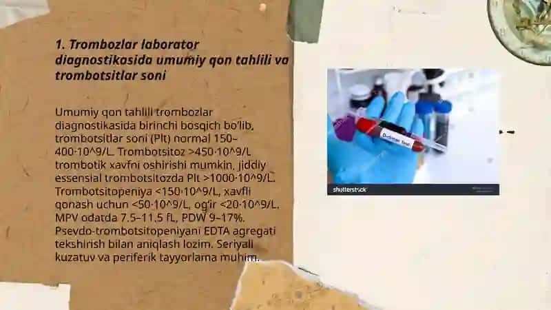 Trombozlar laborator diagnostikasi 3