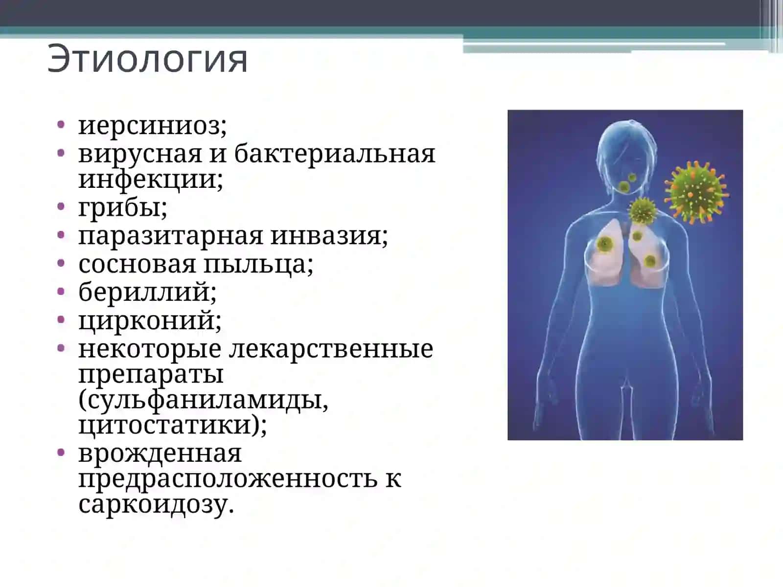 Саркоидоз легких (болезнь Бенье-Бека-Шауманна) 3