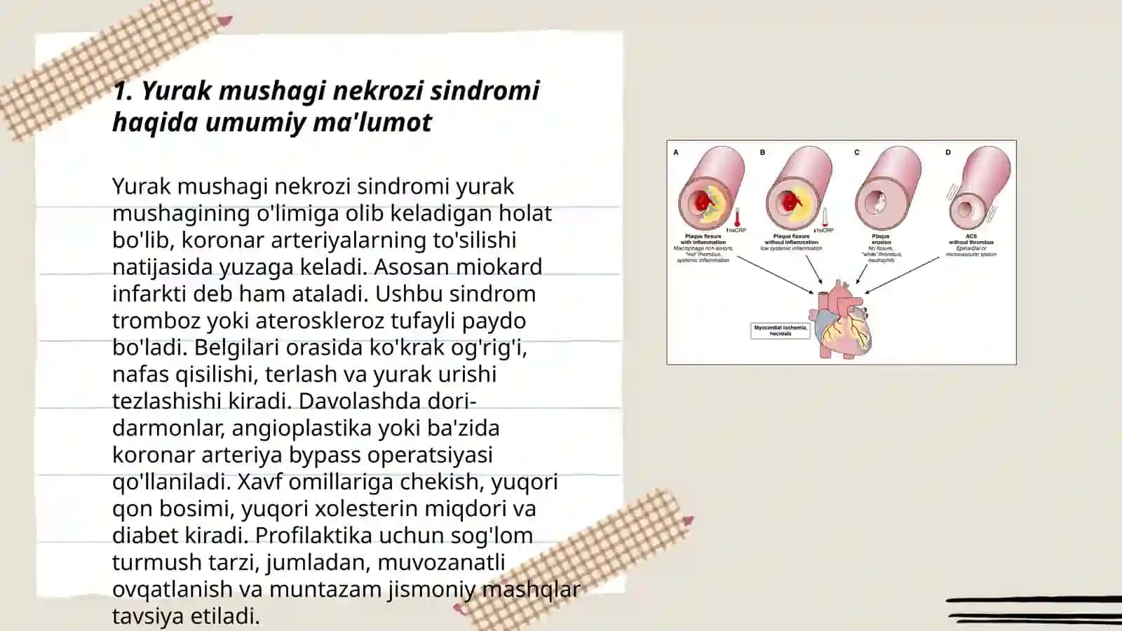 Yurak mushagi nekrozi sindromi 3