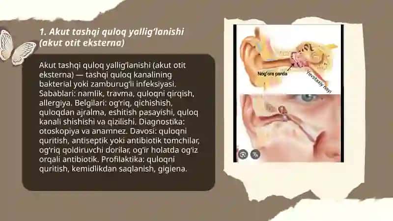 Akut tashqi quloq yalligʻlanishi (akut otit eksterna) 3