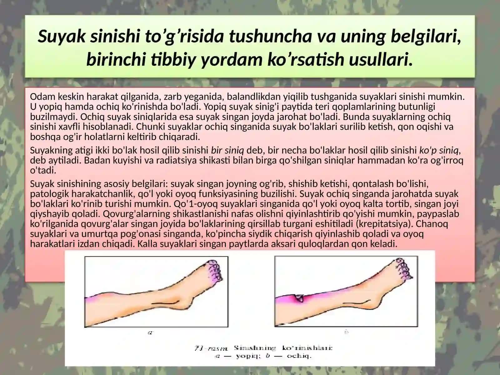 Suyak sinishining tushunchalari 3