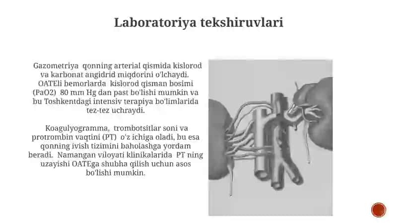 O'pka arteriyasi tromboemboliyasi 3