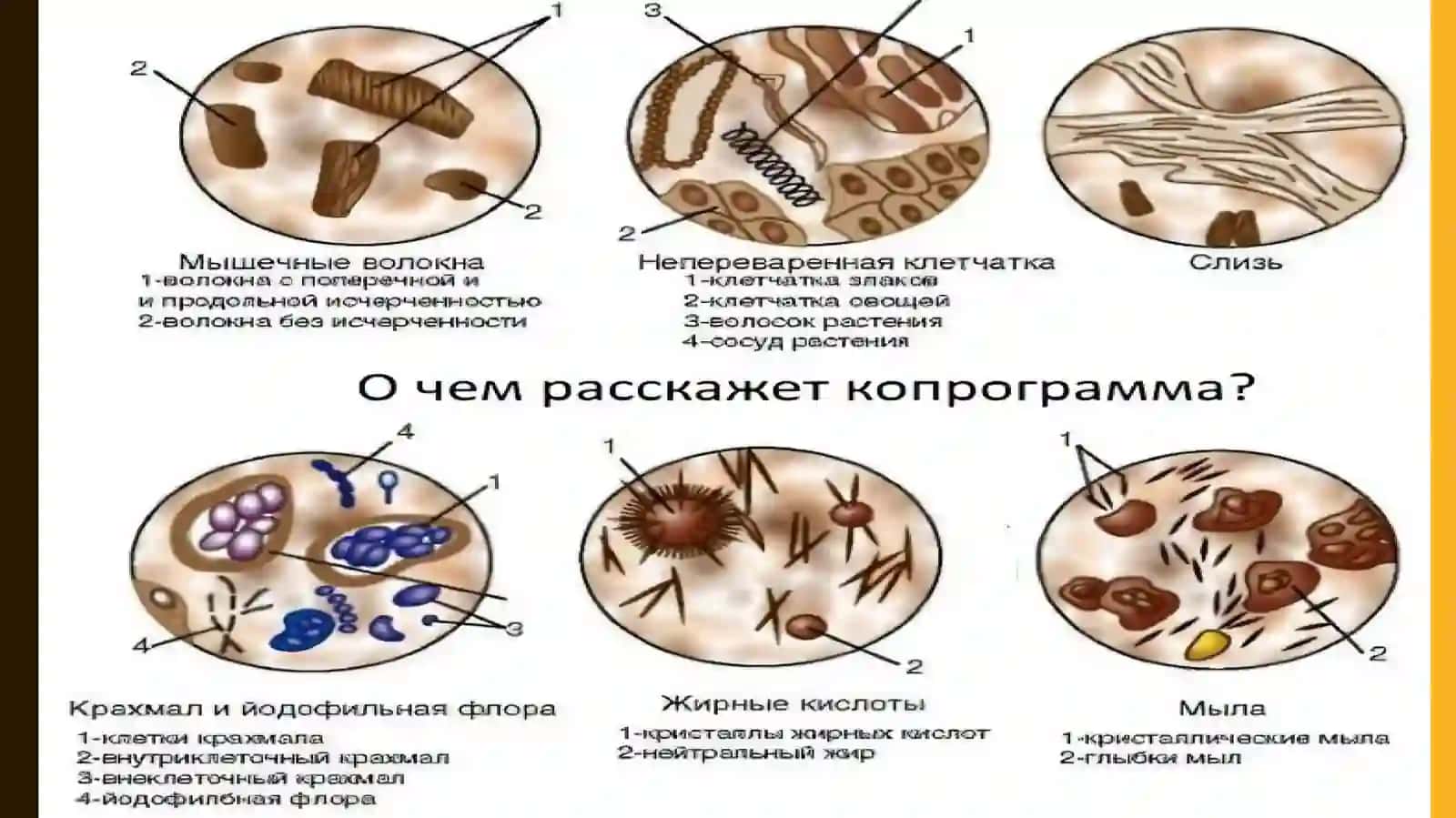 Umumiy axlat taxlilini interpitatsiyasi 3