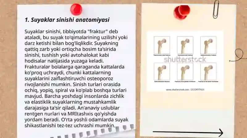Suyaklar sinishi 3