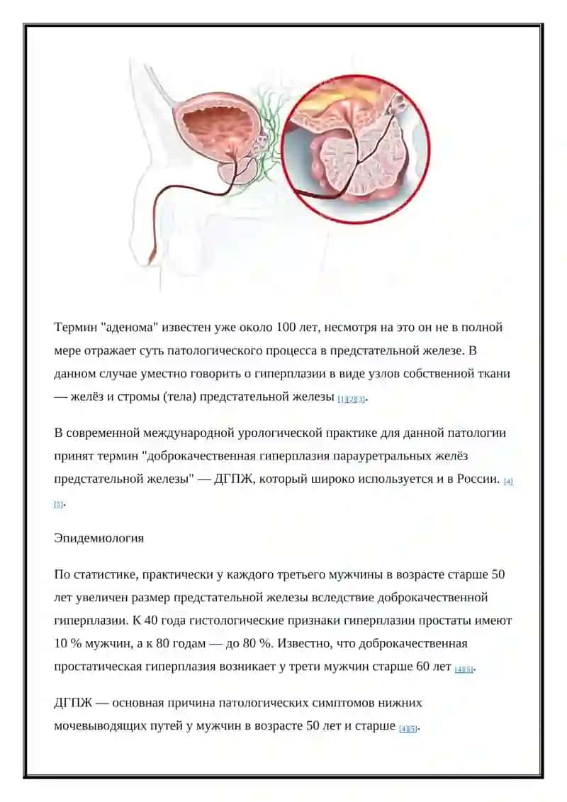 Аденома предстательной железы 3