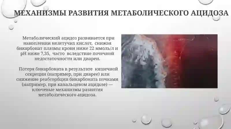 Дыхание и метаболический ацидоз 3