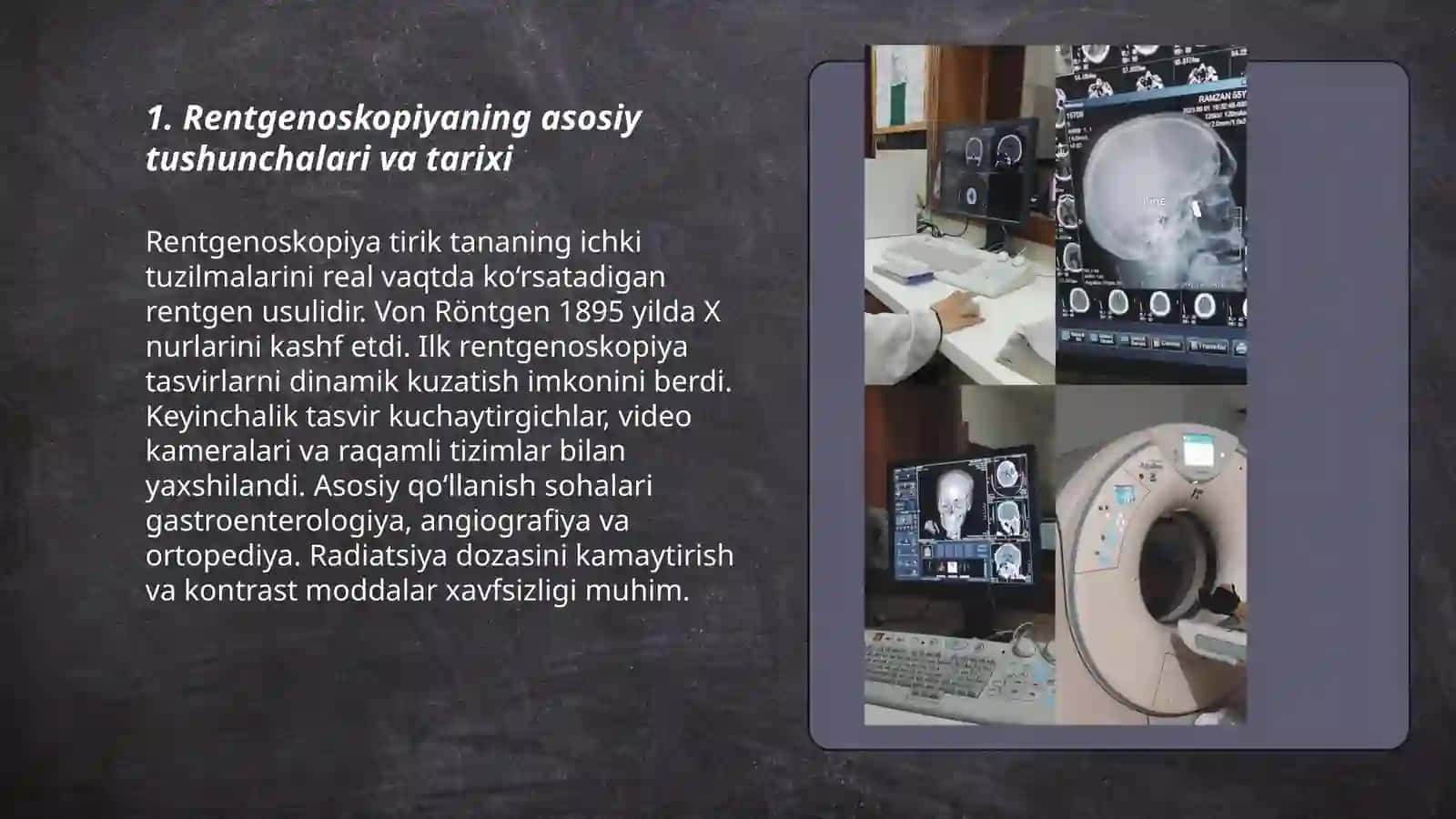 Rentgenoskopiya 3