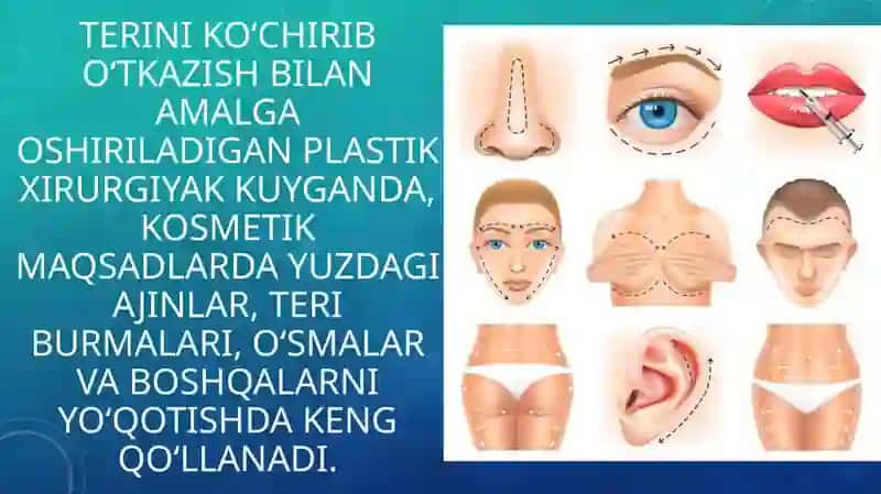 Yuzdagi plastik operatsiyalar xususiyatlari 3
