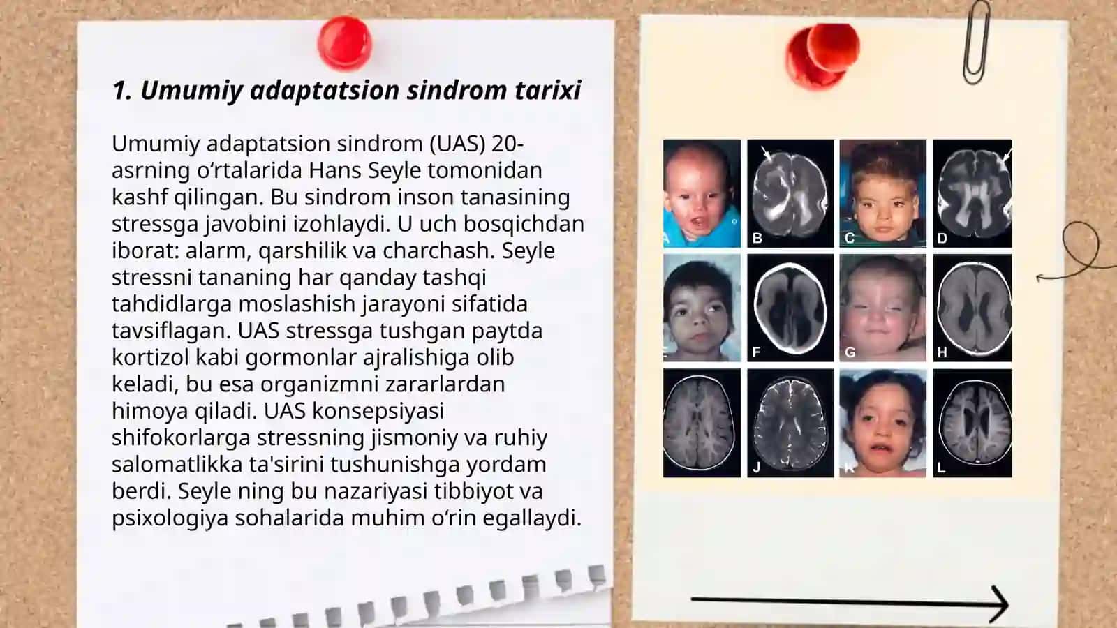 Umumiy adaptatsion sindrom 3