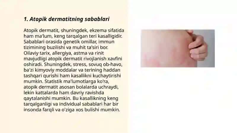 Atopik dermatit 3