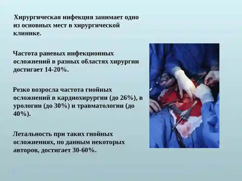 ИНФЕКЦИОННЫЕ ОСЛОЖНЕНИЯ ОГНЕСТРЕЛЬНЫХ РАН 3