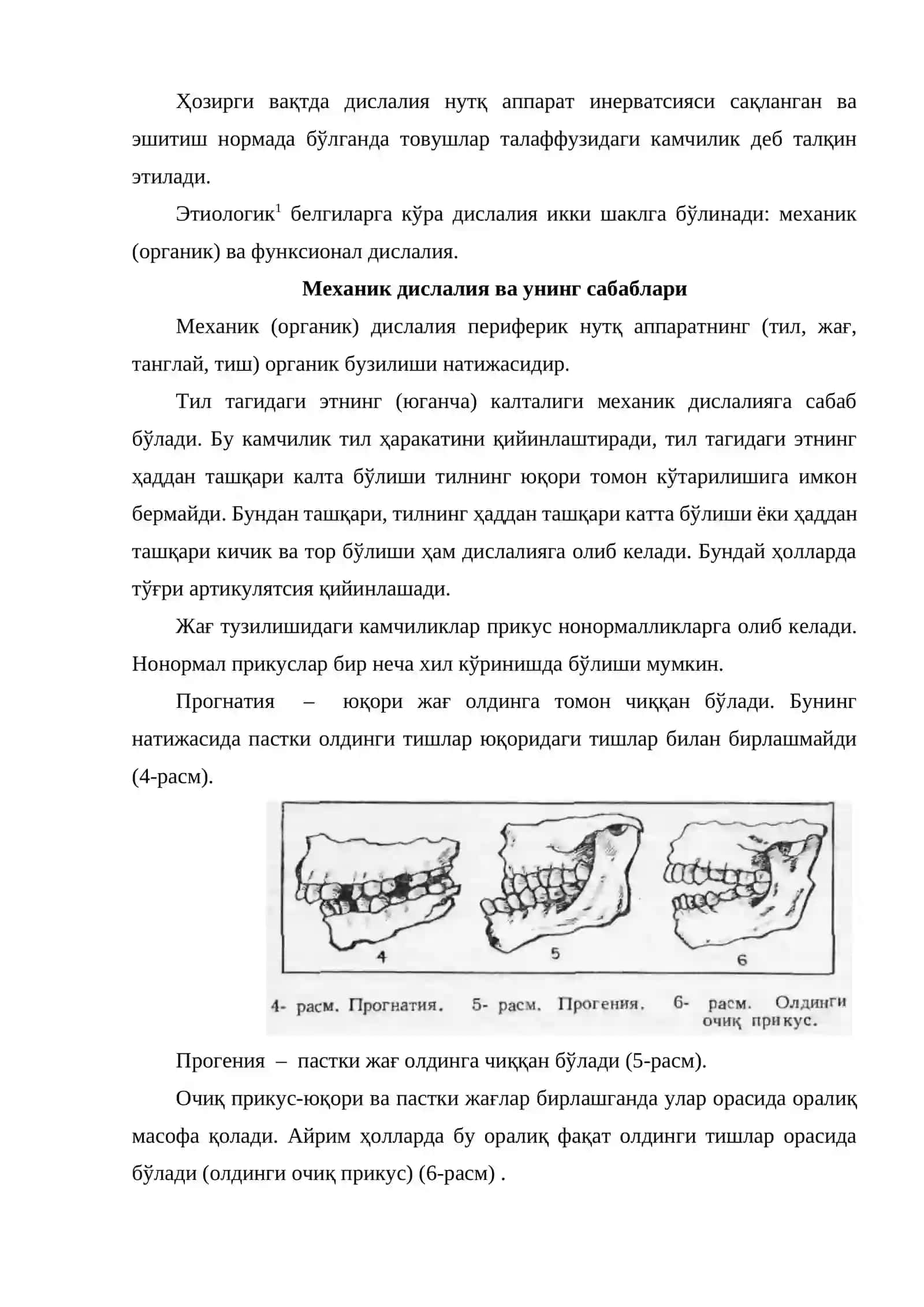 Дислалия 3