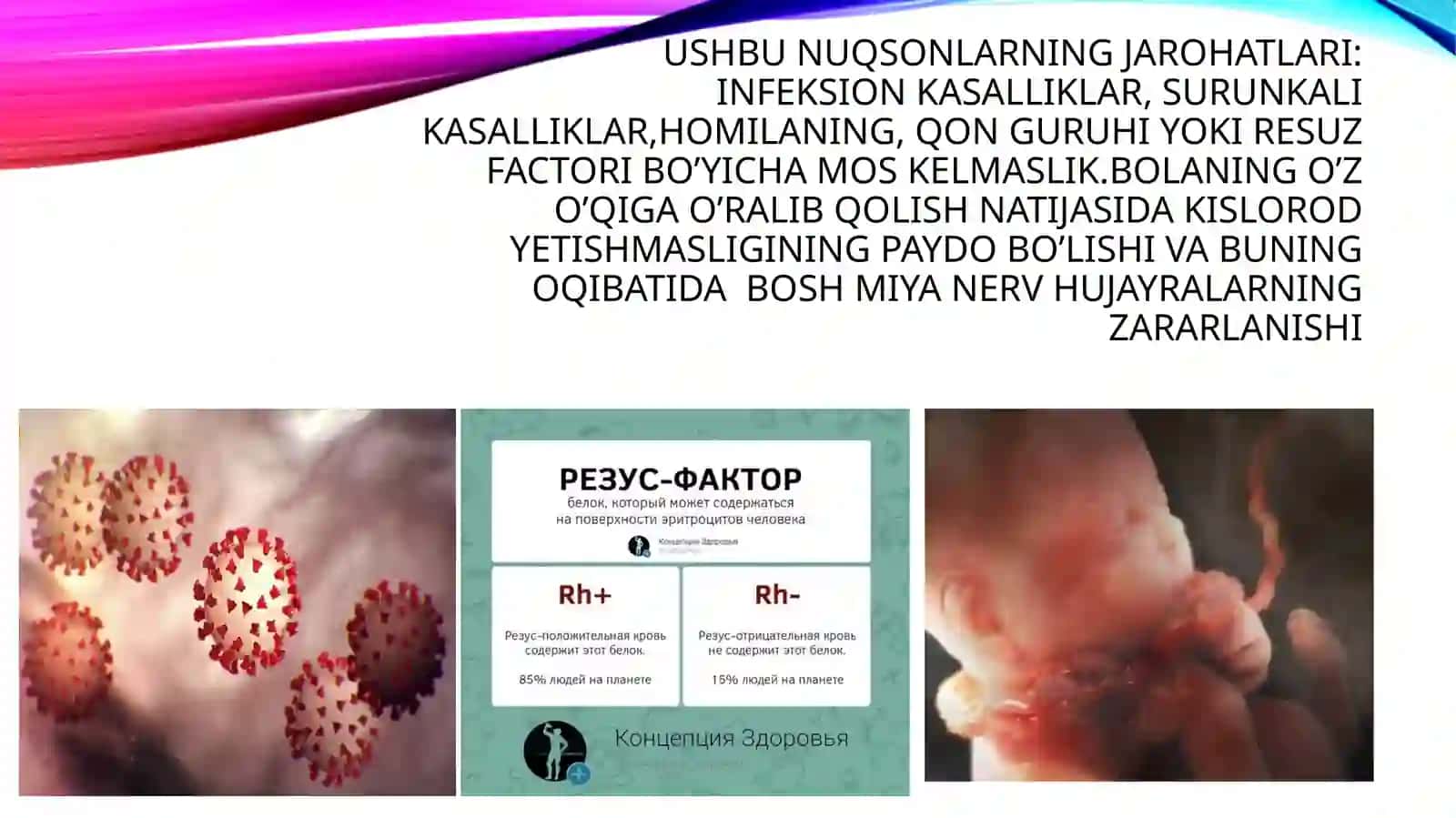 Tayanch- harakatida nuqsoni bo’lgan bolalar 3