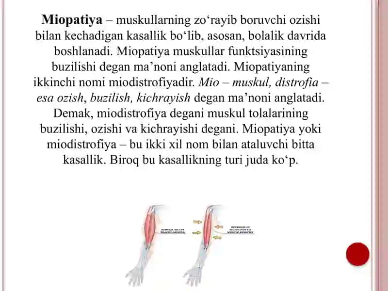 Miopatiyalar. Mushaklar denervatsiyasi 3