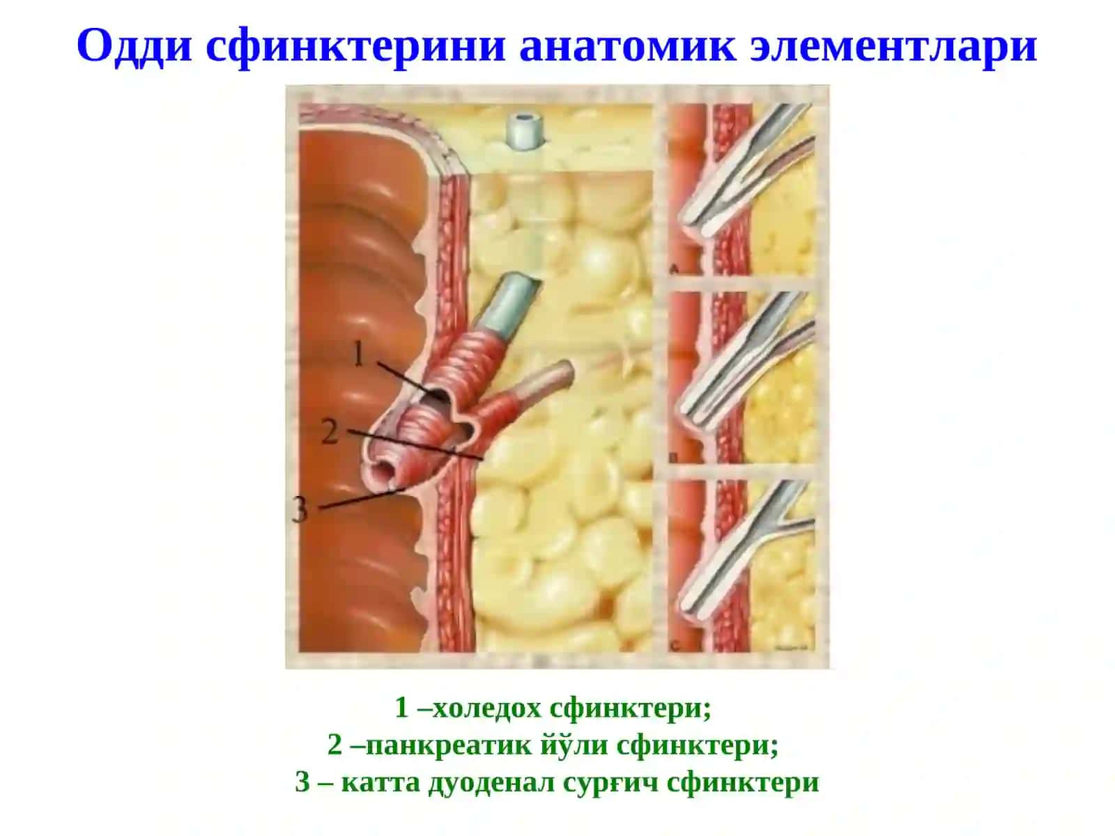 Механик сариқлик, постхолецистэктомик синдром 3